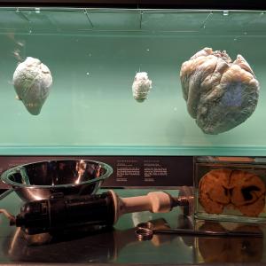 Retsmedicinske redskaber foran akvarium med hjerter
